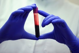 Made-in-B.C. test determines which parent passed on gene linked to increased cancer risk 