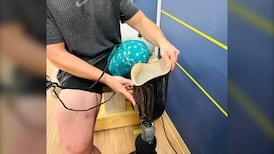 3D-printed custom prosthetic sockets developed at B.C. university 