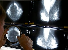 Regions in Canada that face the highest rates of breast cancer, study reveals